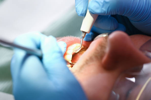 Best Dentist for Tooth Abscess  in Dunes City, OR