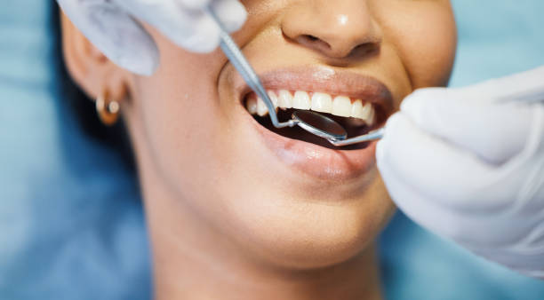 Best Teeth Whitening  in Dunes City, OR